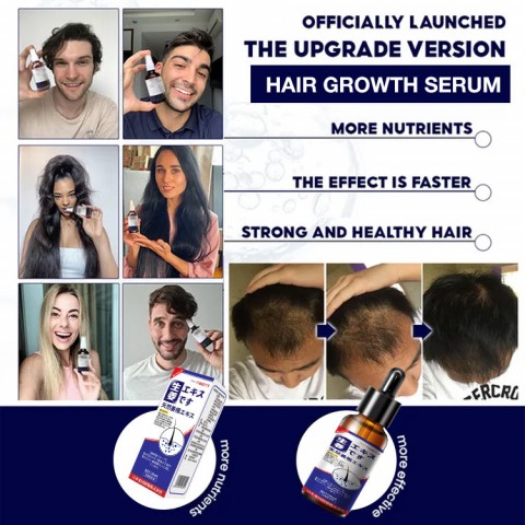 Hair growth serum