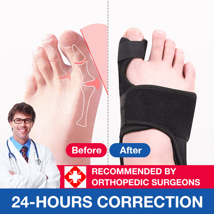 Valentine's Day Promo Second one only ₱300 - Stable Support Bunion Brace - Say goodbye to bunions!